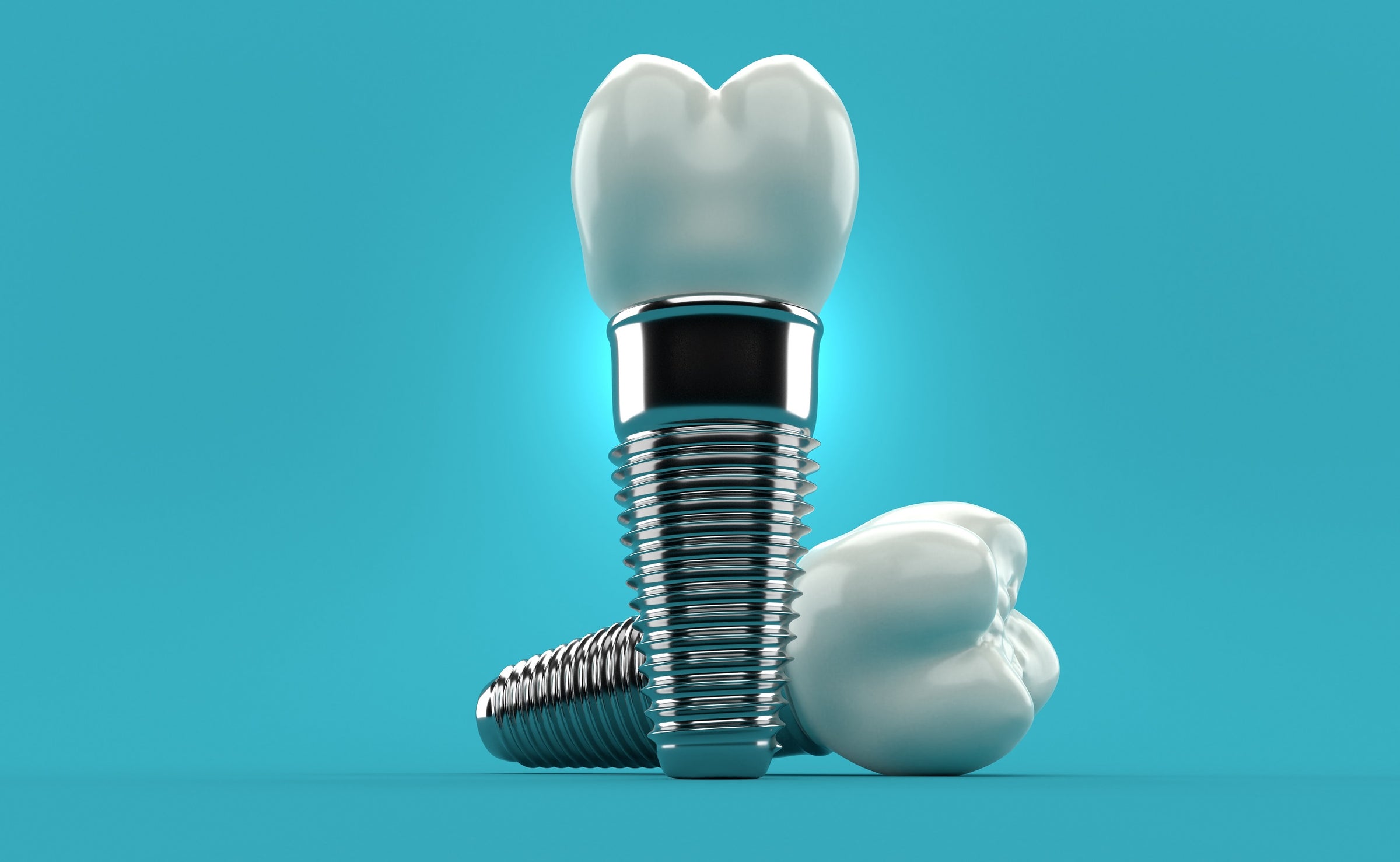 Implant System