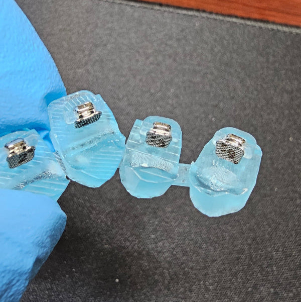 Custom Braces - We made orthodontic treatment easy!