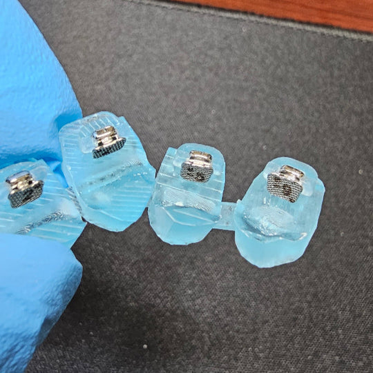 Custom Braces - We made orthodontic treatment easy!