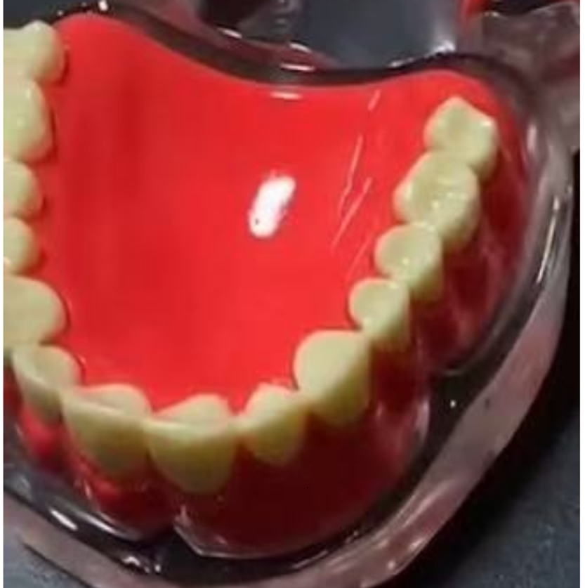 Implant Model Full Mouth Denture Mandible or Maxilla