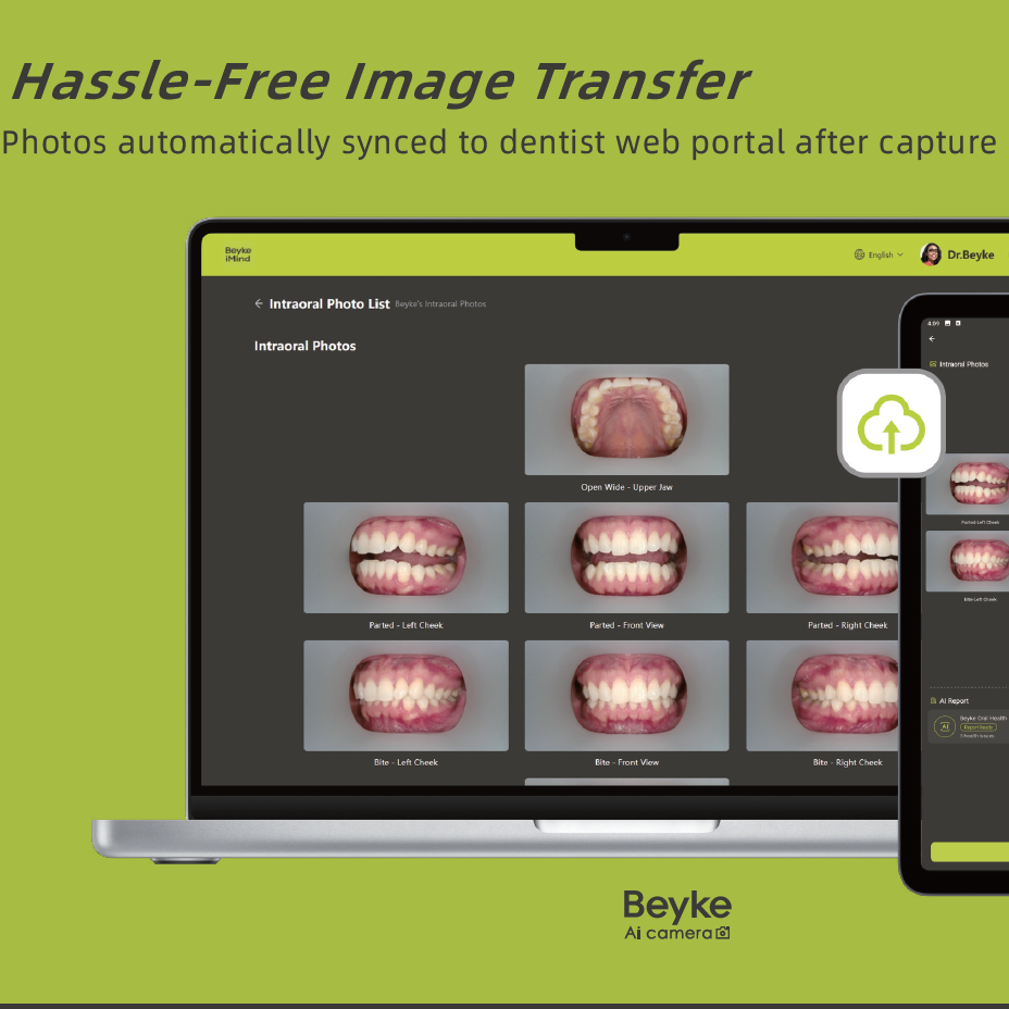 Beyke AI Camera – AI-Guided Intraoral Photography System