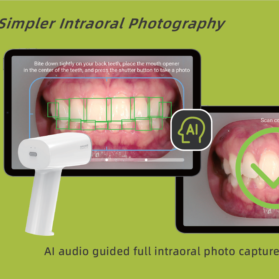 Beyke AI Camera – AI-Guided Intraoral Photography System
