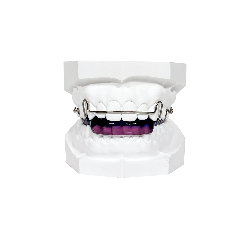 Activator Functional Appliance custom orthodontic appliance