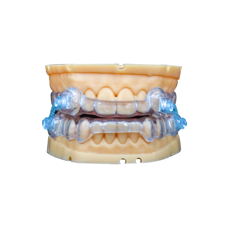 Connector-Style Mandibular Advancement Appliance custom orthodontic appliance