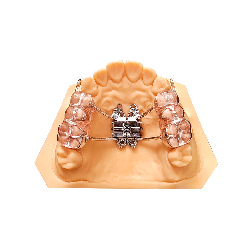 Custom MSE Skeletal Expander custom orthodontic appliance