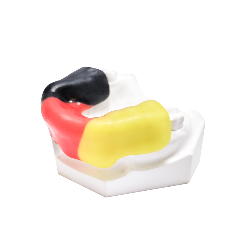 Custom Sports Mouthguard custom orthodontic appliance
