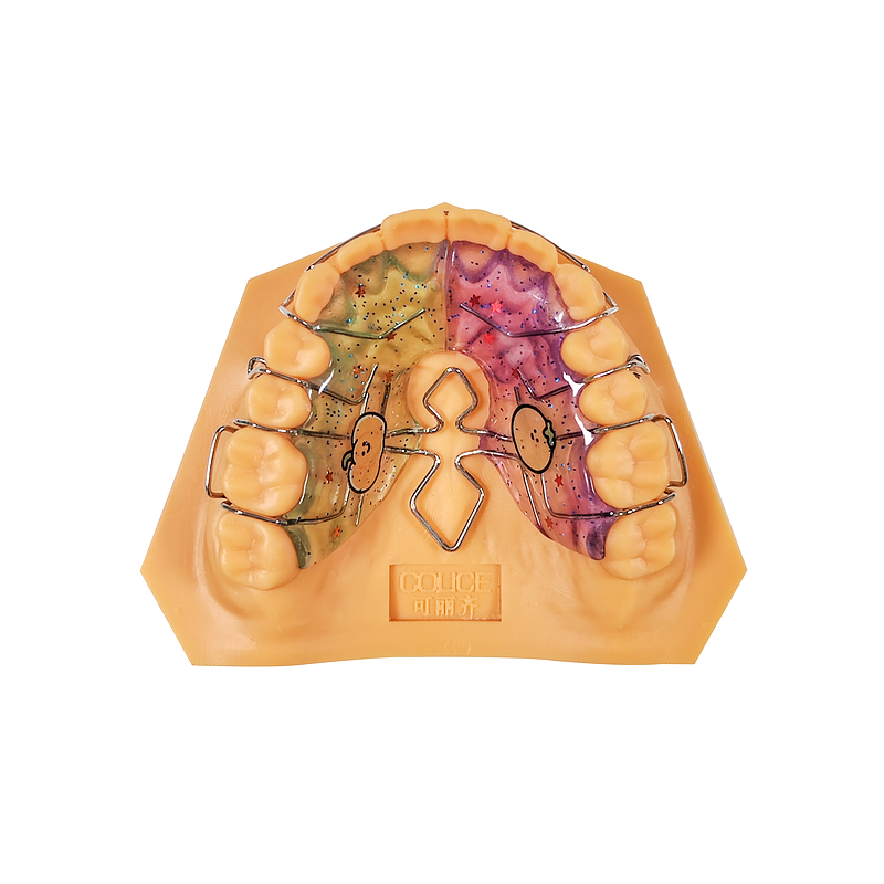Diamond-Framework Palatal Expander custom orthodontic appliance