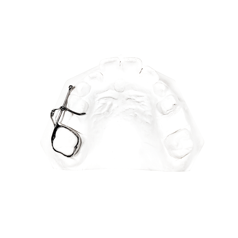 Eruption Guidance Appliance custom orthodontic appliance