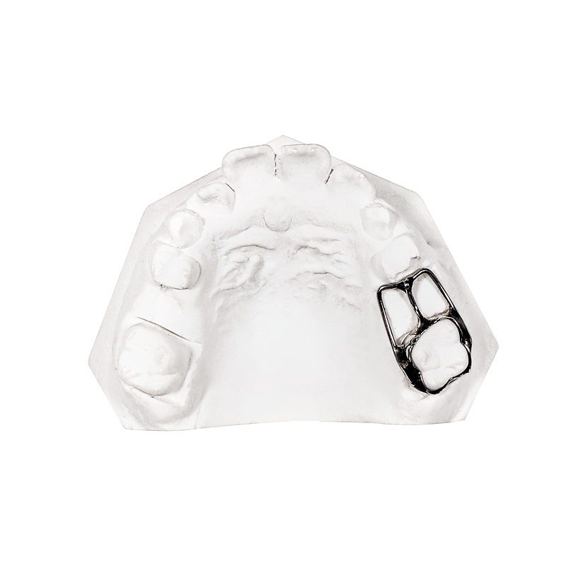Eruption Inhibitor Appliance custom orthodontic appliance