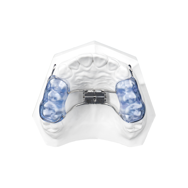 Expansion and Protraction Appliance custom orthodontic appliance