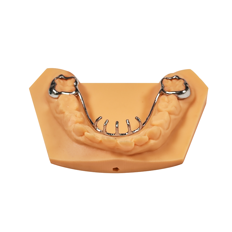 Fixed Tongue Crib with Spikes custom orthodontic appliance