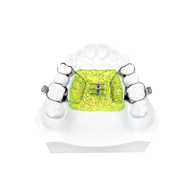 Haas Palatal Expander custom orthodontic appliance