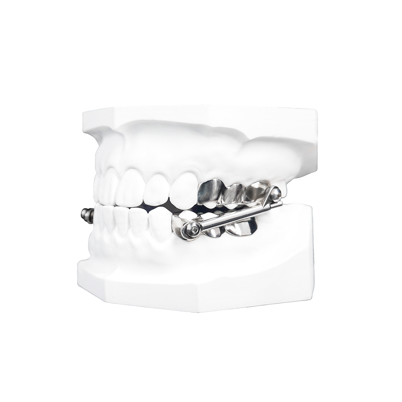 Herbst Functional Appliance custom orthodontic appliance