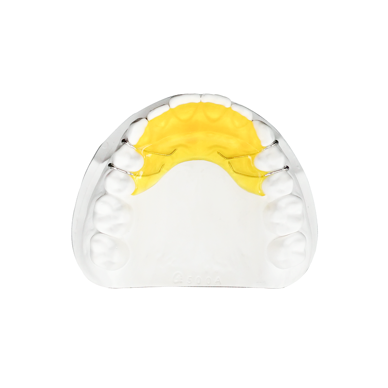 Inclined Bite Plane custom orthodontic appliance