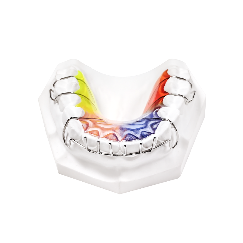 Lip Bumper with Habit Spikes custom orthodontic appliance