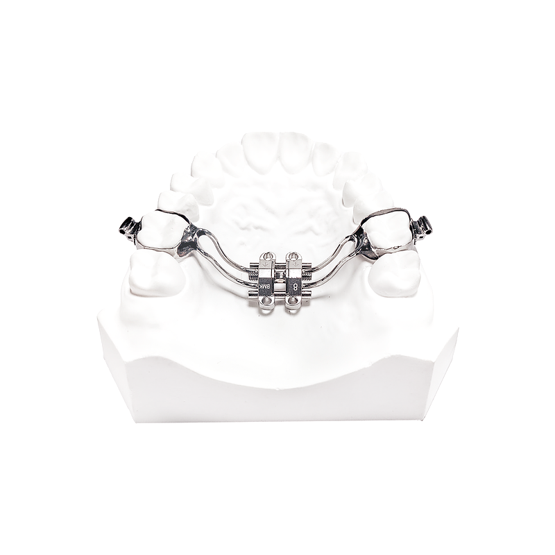 MSE Skeletal Expander custom orthodontic appliance