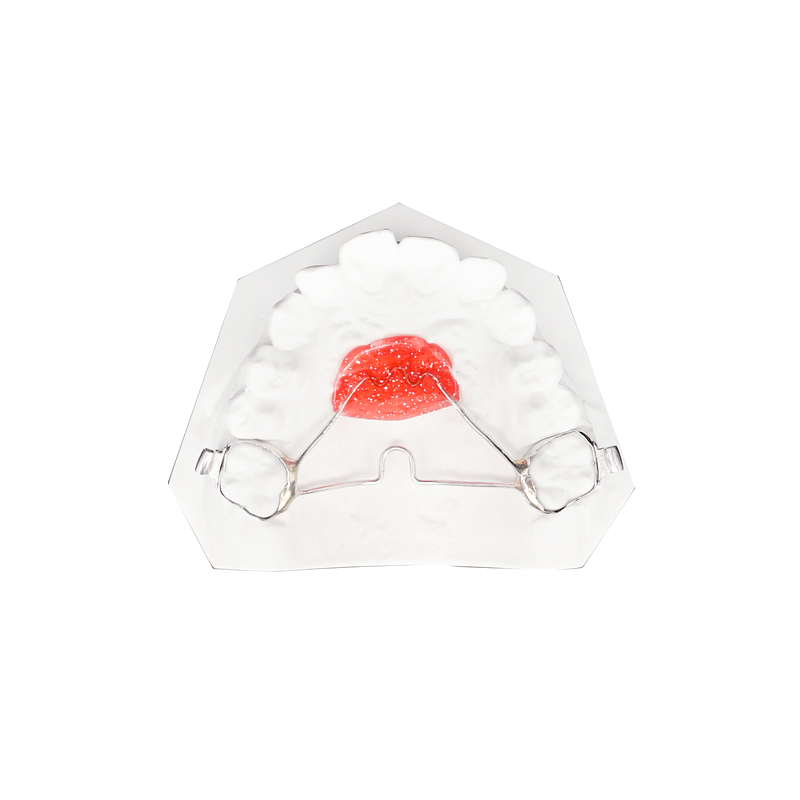 Nance Holding Arch custom orthodontic appliance