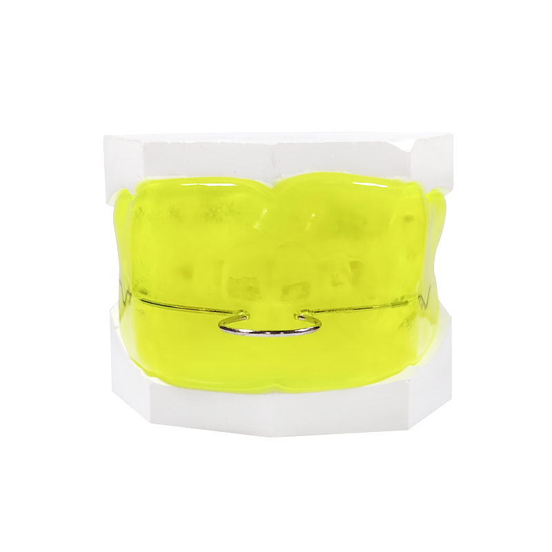 Oral Vestibular Shield custom orthodontic appliance