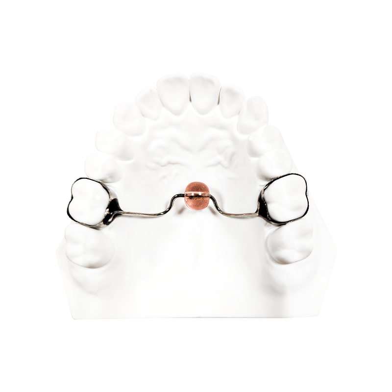 Palatal Bead Appliance custom orthodontic appliance