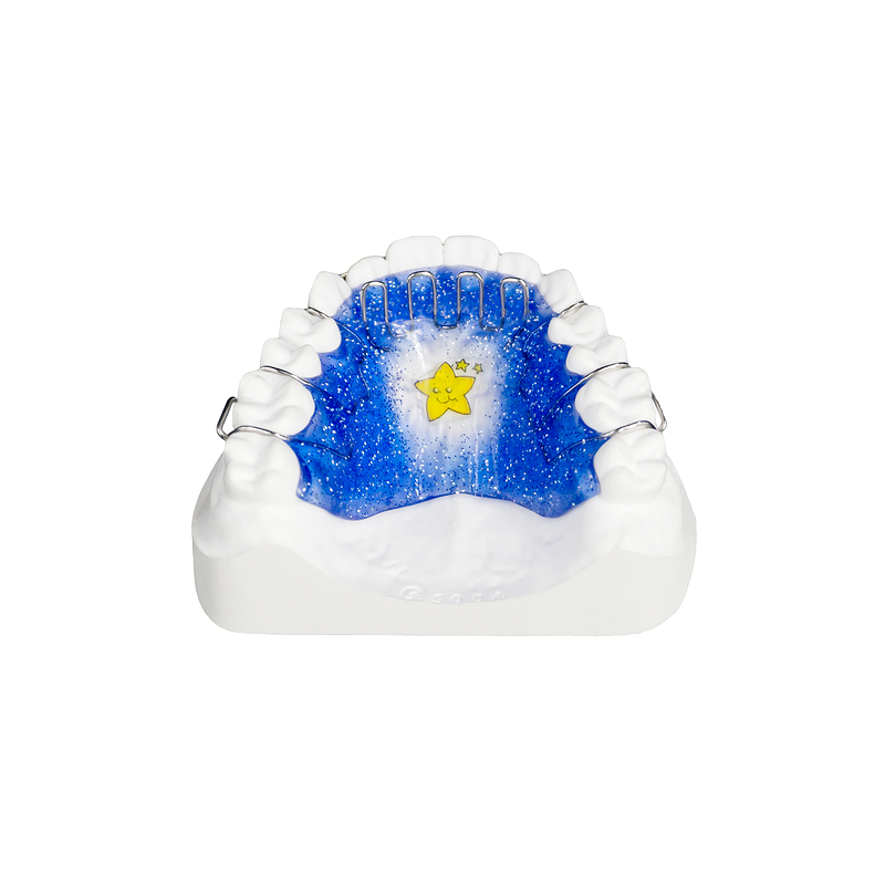 Palatal Crib Appliance custom orthodontic appliance