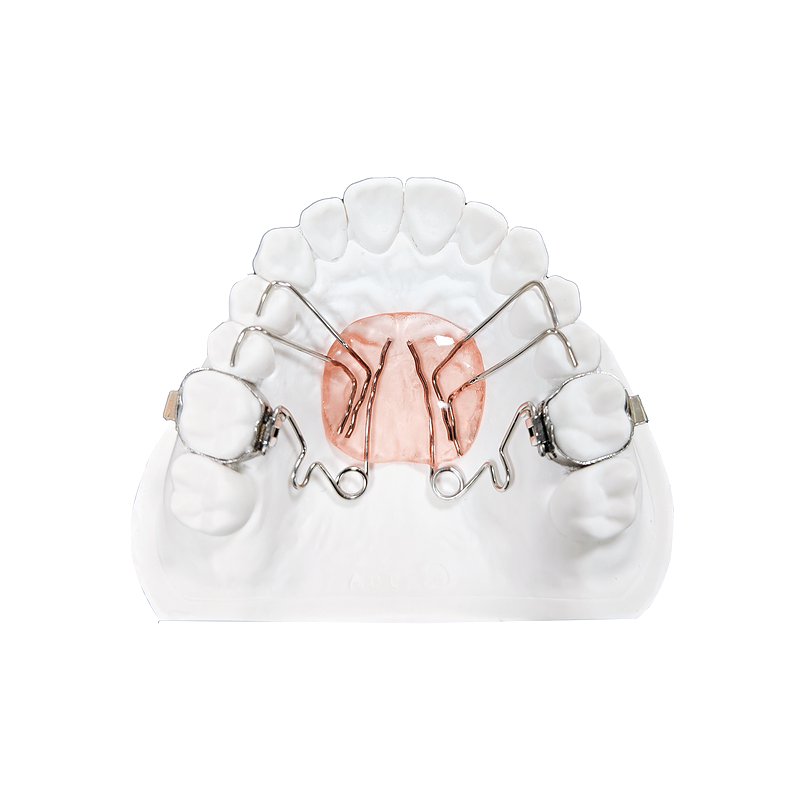 Pendulum Molar Distalizer custom orthodontic appliance