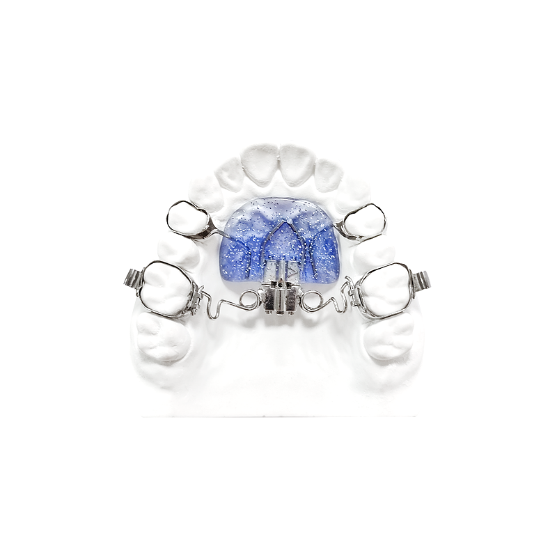 Pendulum Molar Distalizer – Blue Acrylic custom orthodontic appliance