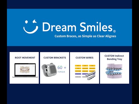 Custom Braces - as easy as clear aligners!