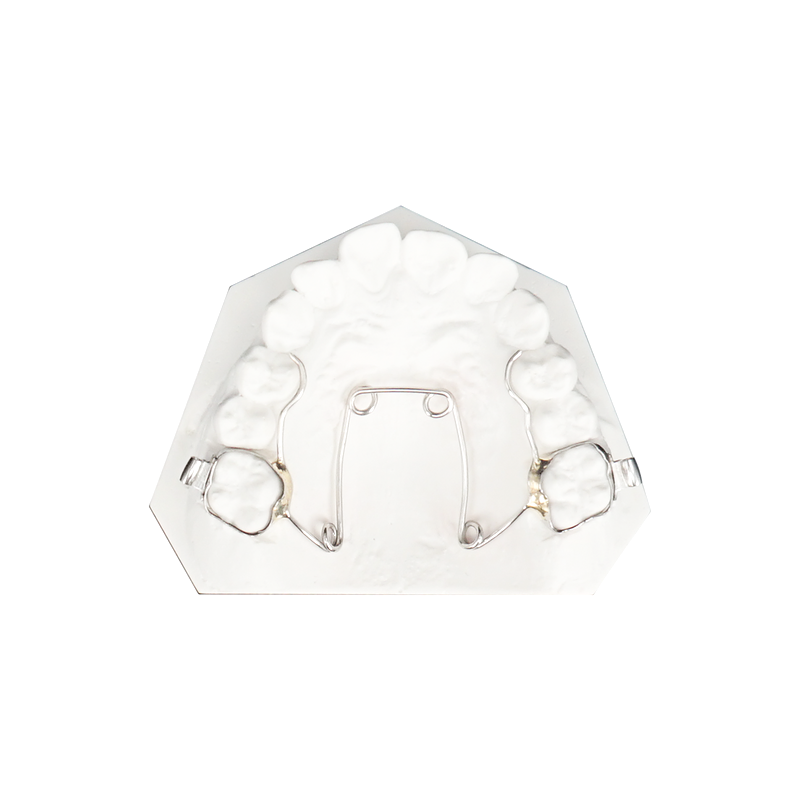 Quad Helix Expander custom orthodontic appliance