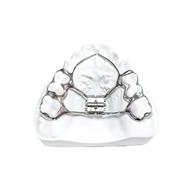 Rapid Palatal Expander custom orthodontic appliance