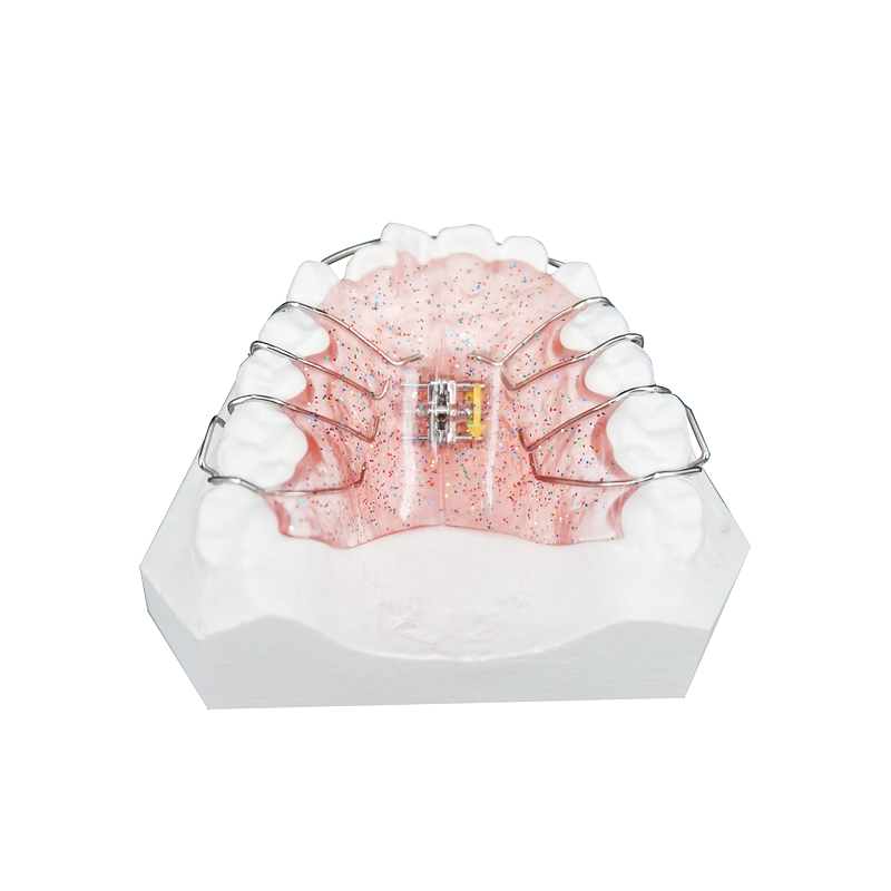 Removable Expansion Appliance custom orthodontic appliance