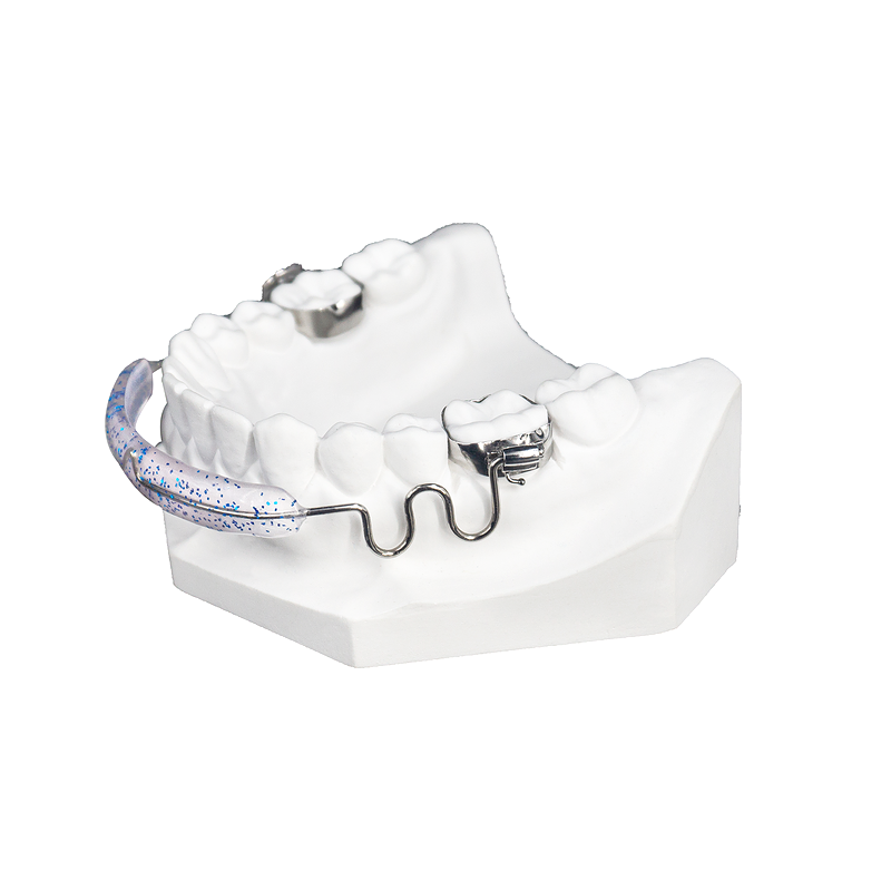 Removable Tongue Crib custom orthodontic appliance