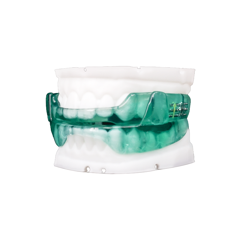 Shark-Style Mandibular Advancement Appliance custom orthodontic appliance
