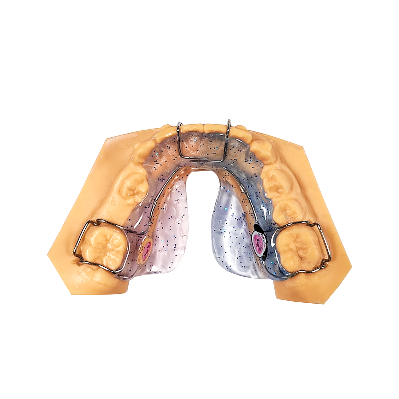 Tongue Elevator Appliance custom orthodontic appliance