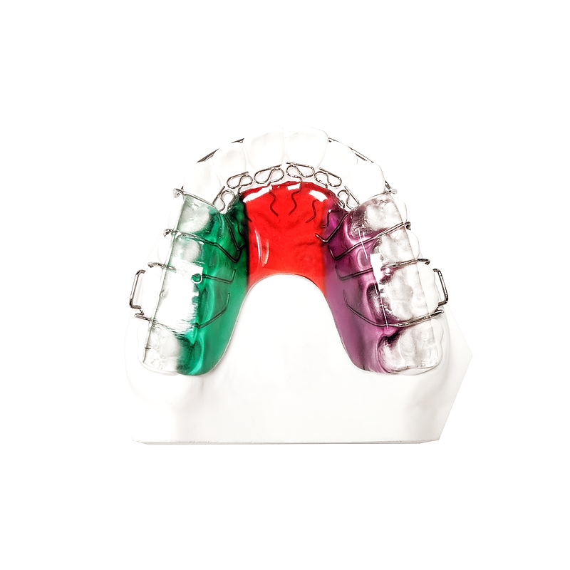 Tongue-Spring Bite Plate custom orthodontic appliance