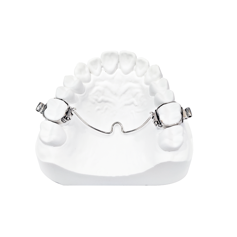 Transpalatal Arch (TPA) custom orthodontic appliance