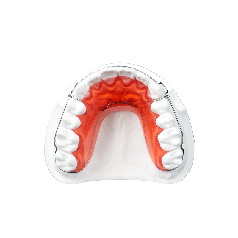 Wraparound Retainer custom orthodontic appliance